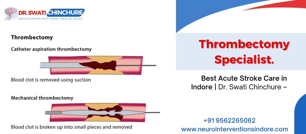 "Dr. Swati Chinchure, Neurointerventional Radiologist in Indore, explaining thrombectomy procedures for acute stroke care with contact details."