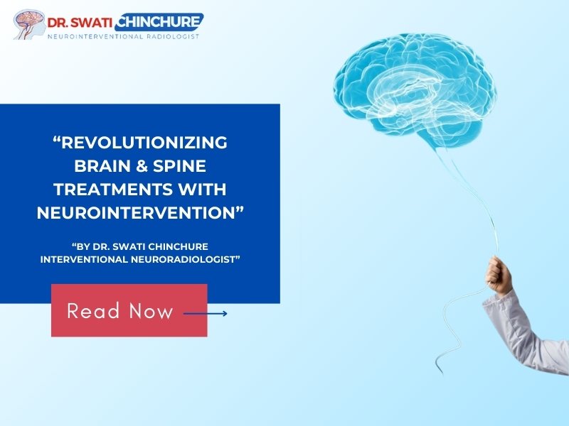 "Promotional graphic for neurointervention treatments by Dr. Swati Chinchure featuring a brain balloon and call to action to read more."