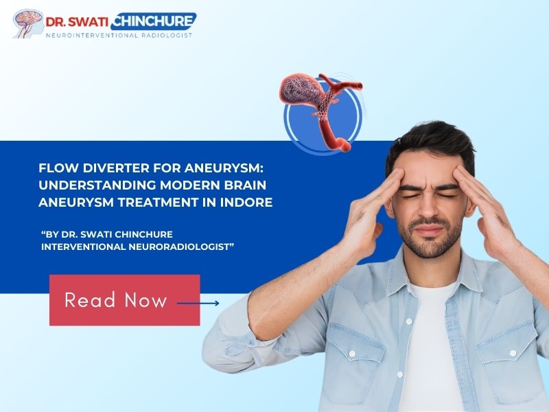 FLOW DIVERTER FOR ANEURYSM: UNDERSTANDING MODERN BRAIN ANEURYSM TREATMENT IN INDORE